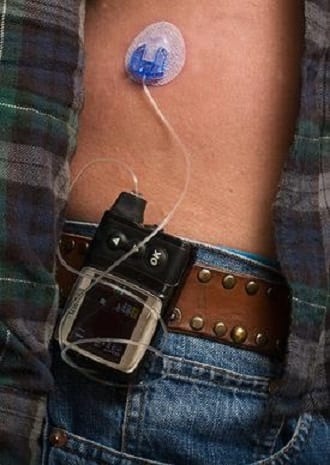 In medtech, Massachusetts needs to play catch-up